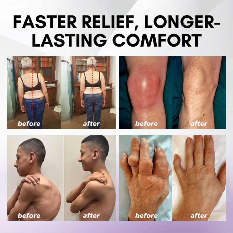 ⏰2026 New Year Special Offer🔥: SEAGRIL™ Turmeric Emu Oil Arthritis Relief and Pain Relief Massage Gel👨‍⚕️ Certified by the American Osteopathic Association (AOA)
