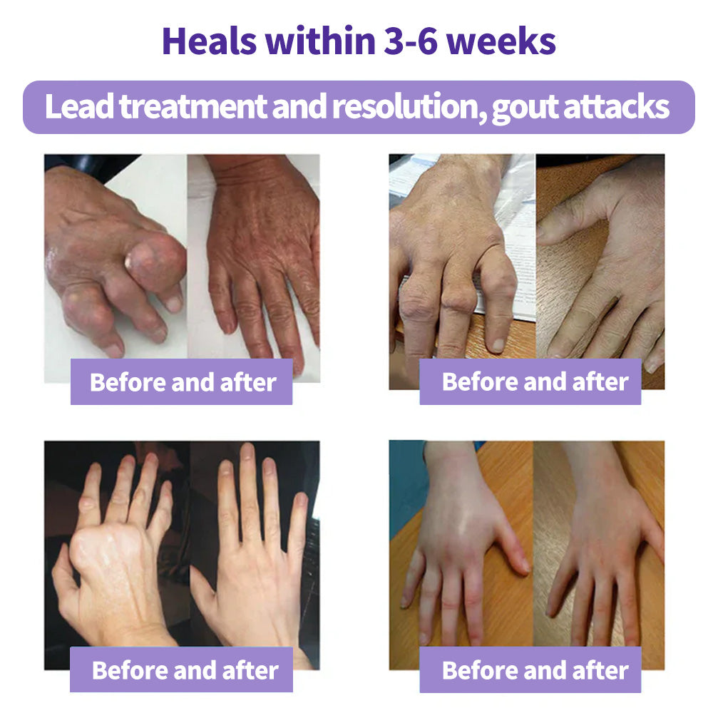 ⏰2026 New Year Special Offer🔥: SEAGRIL™ Turmeric Emu Oil Arthritis Relief and Pain Relief Massage Gel👨‍⚕️ Certified by the American Osteopathic Association (AOA)