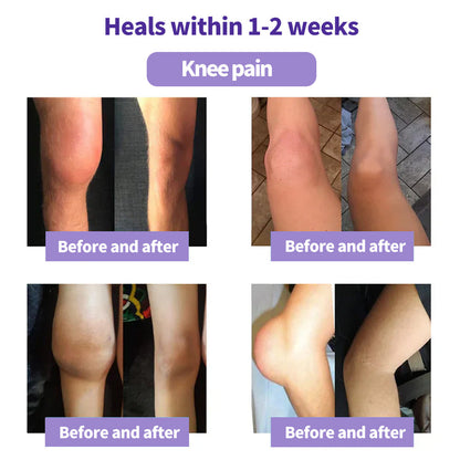 ⏰2026 New Year Special Offer🔥: SEAGRIL™ Turmeric Emu Oil Arthritis Relief and Pain Relief Massage Gel👨‍⚕️ Certified by the American Osteopathic Association (AOA)