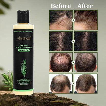 🔥LAST DAY 50% OFF - 🌿Alisanda® Organic Rosemary Hair Growth Shampoo