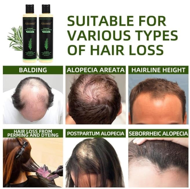 🔥LAST DAY 50% OFF - 🌿Alisanda® Organic Rosemary Hair Growth Shampoo