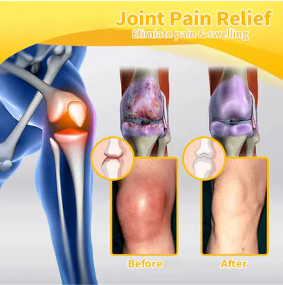 PainGuard Joint Gel – OSTEOARTHRITIS ARTHRITIS CREAM