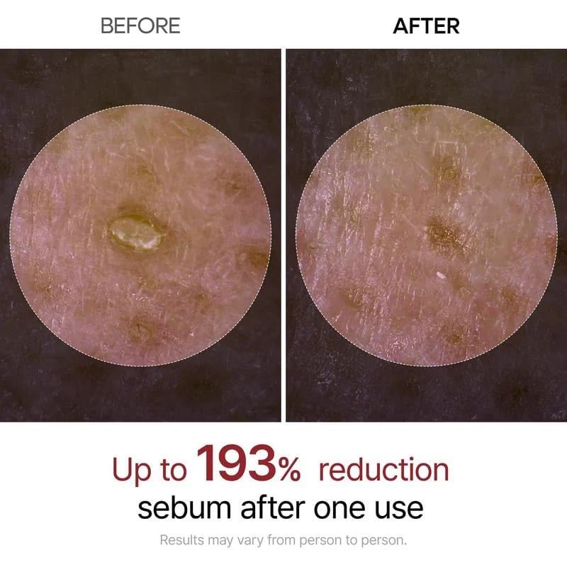 🏆Flash Sale⚡ 50K+ SOLD! Almost Gone-💥🔥 Glow Rice Ampoule Duo