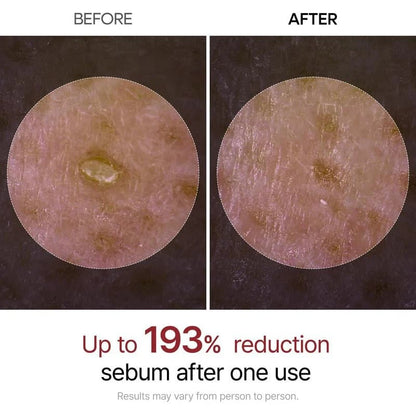 🏆Flash Sale⚡ 50K+ SOLD! Almost Gone-💥🔥 Glow Rice Ampoule Duo