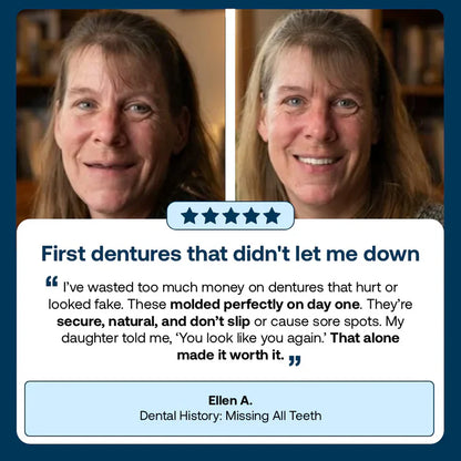 🌎Ends Today: 70% OFF! ⏰ Medical Full Denture with Strong Suctiond🦷Obtain American Dental Association (ADA) Certification